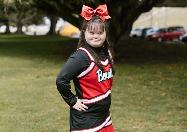 Down syndrome in children